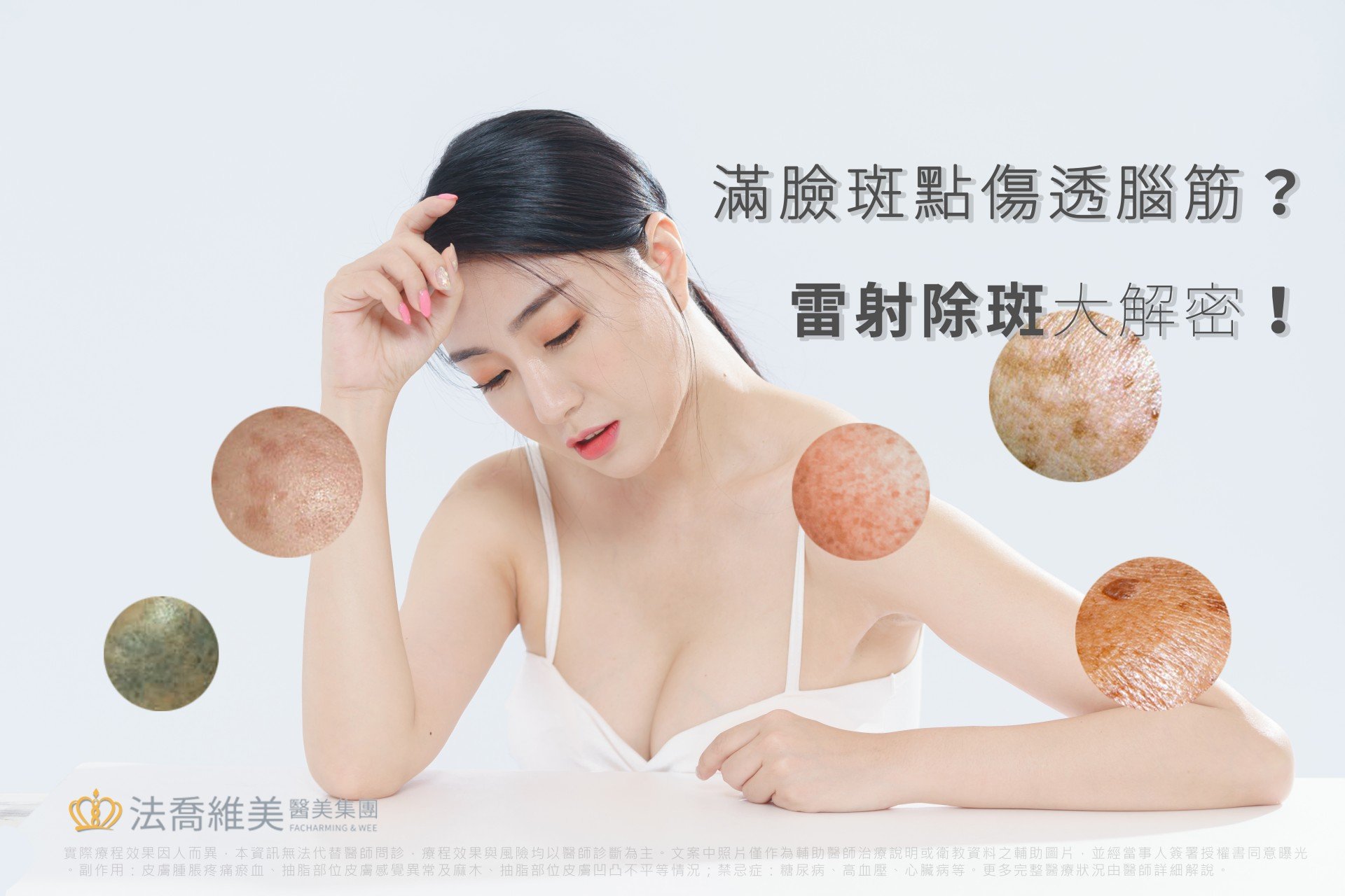 滿臉斑點傷透腦筋?雷射除斑大解密!