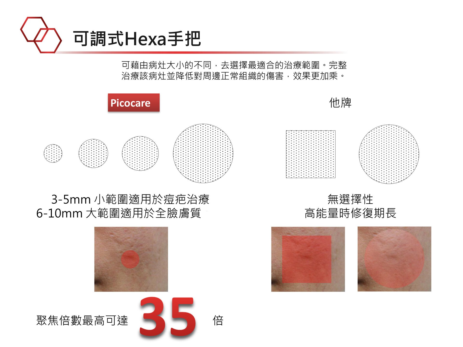 法喬維美Picocare蜂巢皮秒改善肌膚問題