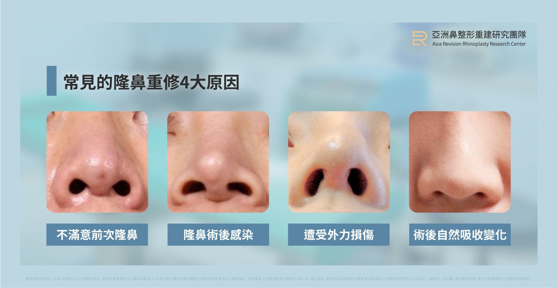 台北高雄二次隆鼻法喬邱浚彥